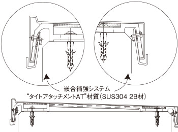 アルウィトラ嵌合補強システム タイトアタッチメントAT(PAT.)